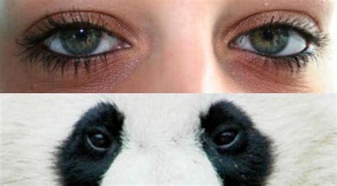 Mata Panda Yang Sudah Parah